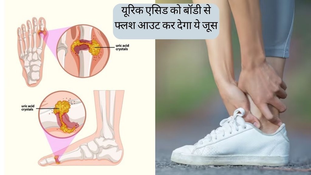 Pineapple Juice for Uric Acid । joint pain । uric acid Home treatment