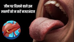 Liver । Liver Damage । Liver Damage Symptoms