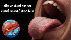 जीभ पर दिख रहे हैं ये लक्षण तो समझ लें ठप पड़ने लगा है आपका लिवर, अस्पताल में हो सकते हैं भर्ती, नजर आते ही तुरंत कराएं जांच