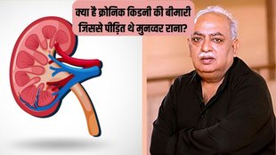 Munawwar Rana । Munawwar Rana Death । Chronic kidney disease