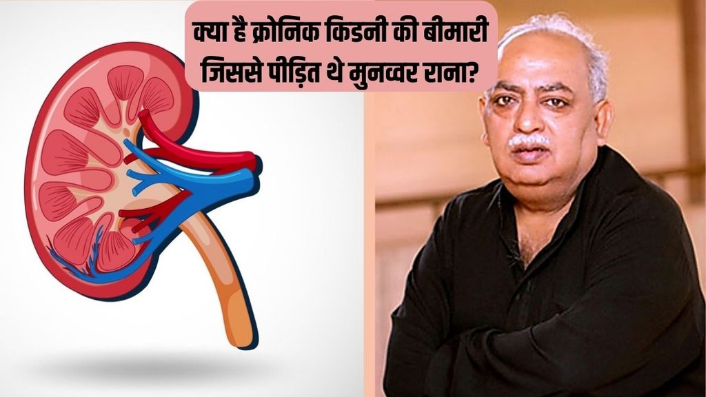 Munawwar Rana । Munawwar Rana Death । Chronic kidney disease