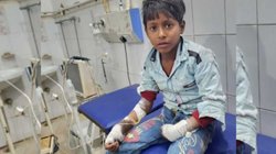 UP: रामलला की शोभा यात्रा के दौरान करंट से झुलसे 9 बच्चे, अखिलेश यादव ने की ये मांग