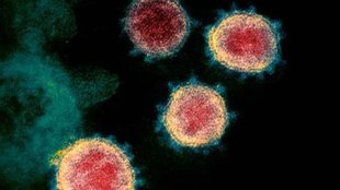 CHINA VIRUS