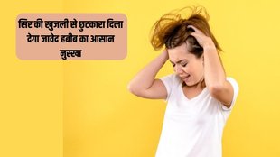 Dry Scalp । Jawed Habib । Jawed Habib Hair Care Tips