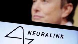 Neuralink Brain Chip,Human Brain Chip Implant,Elon Musk Neuralink