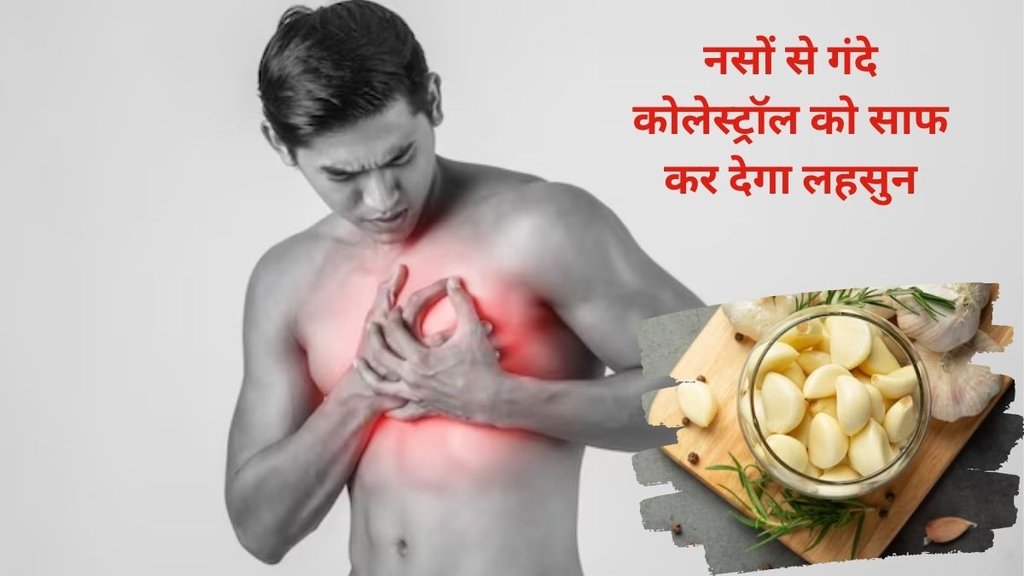 garlic for cholesterol,Cholesterol, Diet for cholesterol, HDL Cholesterol, LDL Cholesterol,High Cholesterol Diet,garlic for Cholesterol control, garlic for Cholesterol control,