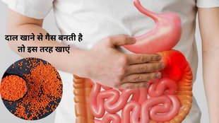 Which dal does not cause gas,Does eating dal cause gas,farting foods,pet me gas banane wali dal,foods for farting