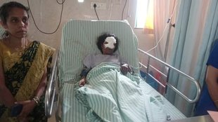 man chops off Anganwadi worker nose