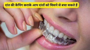 sleep apnea teeth grinding, how to stop clenching jaw, jaw clenching symptoms, Health News,teeth,दांत किटकिटाना,