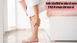 बिना थकान पैरों में लगातार होने वाले दर्द को ना करें इग्नोर, इन गंभीर परेशानियों का हो सकता है संकेत, जानें कब है डॉक्टर के पास जाने की जरूरत