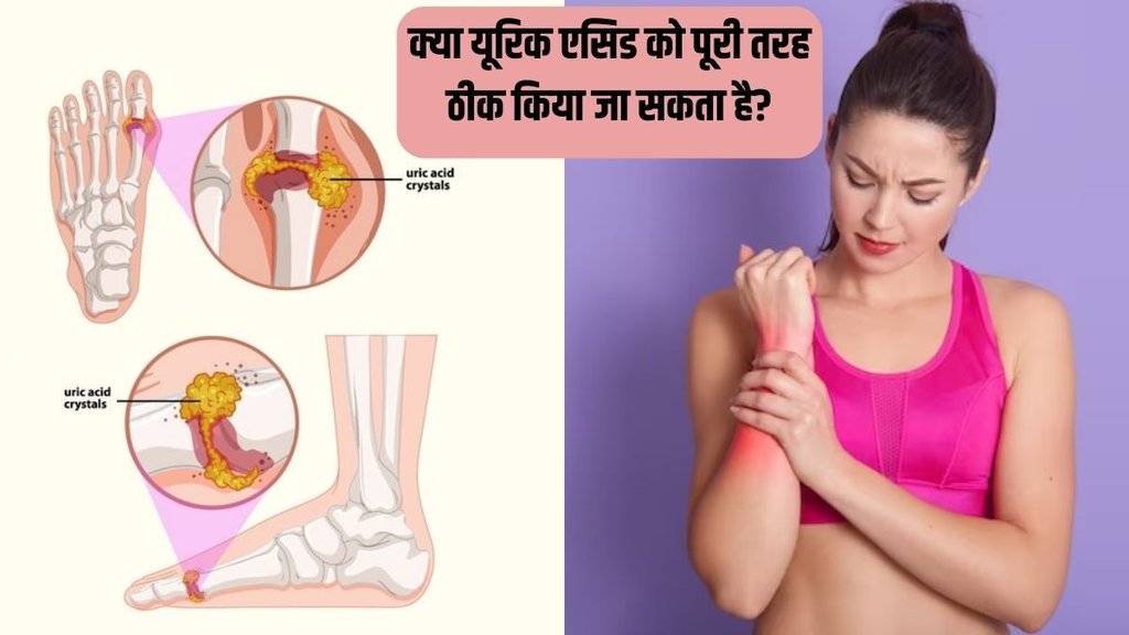 Uric Acid । Uric Acid Remedies । Uric Acid Treatment