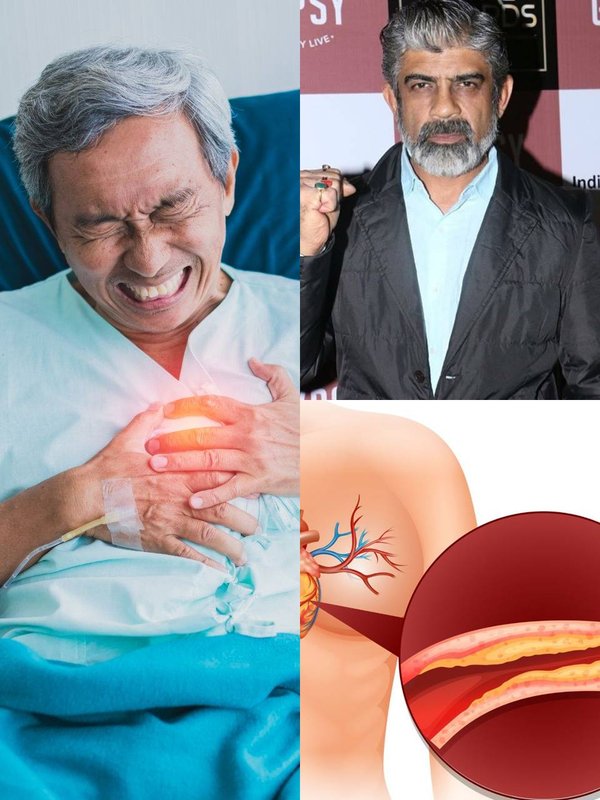 Heart Attack and Cardiac Arrest