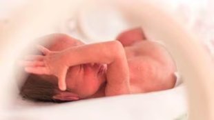 Premature delivery| women