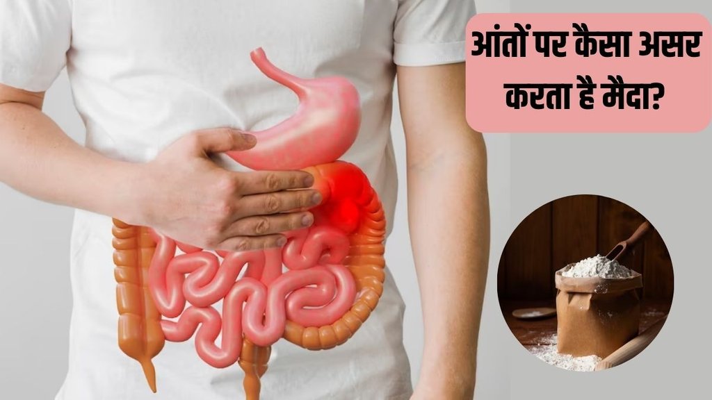 Constipation । Gut Health । maida and gut