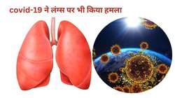 अब भी पीछा नहीं छोड़ रहा covid-19, कोरोना के गंभीर मरीजों के लंग्स पर हुआ हमला, भारत में इसके ज्यादा मामले रिसर्च में हुआ खुलासा
