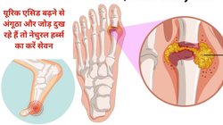 यूरिक एसिड बढ़ने से पैर का अंगूठा सूज कर कुप्पा बन गया है, इन 2 हर्ब्स को रोज़ खाएं, जोड़ों के दर्द से मिलेगी राहत