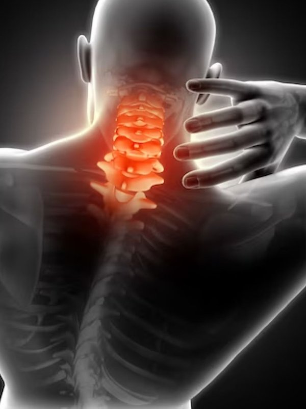 Health,spinal TB,TB, spinal tuberculosis, spinal TB, what is spinal tuberculosis,