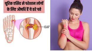Uric Acid । Uric acid Treatment । green corriander for uric acid । corriander for Uric Acid