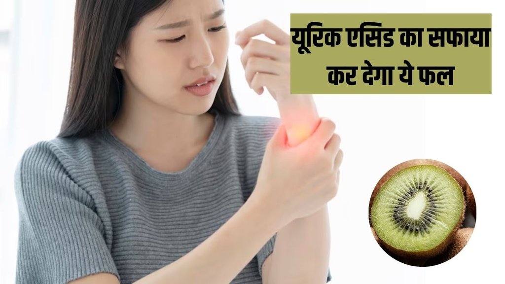 Uric Acid । Kiwi For Uric Acid । Uric Acid Home remedy