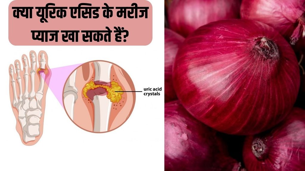 Uric acid । uric acid Remedy । Onion in Uric Acid