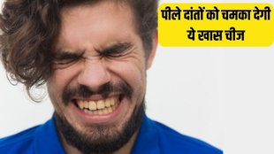 Teeth Whitening Tips । home remedies for white teeth । How to Get Rid of Yellow plaque on Teeth