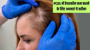 Hair Loss due to PCOS । Tips To Stop Hair Loss From PCOS । how to stop hair loss due to pcos