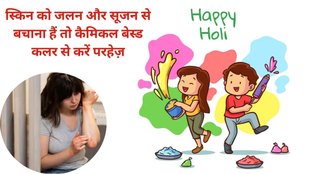 chemical colour free holi, holi colour chemical free,psoriasis patient holi colour,psoriasis skin care tips,psoriasis chemical peel,psoriasis itching,psoriasis itching remedy