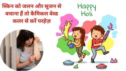 Tips to Celebrate Safe and Healthy Holi: होली पर सोरायसिस मरीज इन बातों का रखें ध्यान, वरना बढ़ सकती है स्किन की समस्या, Holi सेलिब्रेट करने के लिए 6 तरीके अपनाएं