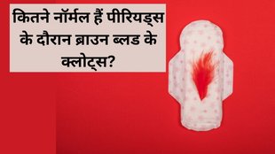 Menstrual Clots । blood clots in periods । is clotting in periods normal