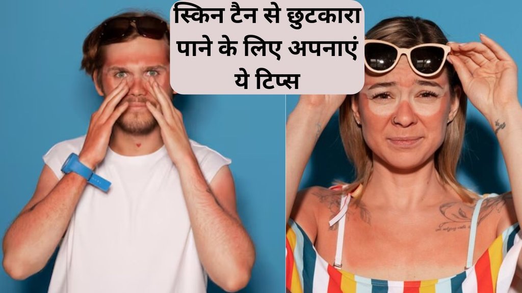 Summer skincare । Tan removing Tips । sun tan