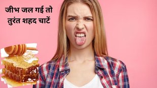 burning tongue cure, home remedies of burning tongue, जीभ जलने का इलाज, जुबान जलने का इलाज, जीभ के इलाज के घरेलू नुस्खें,Burned Tongue, Burnt Tongue Remedies, How To Heal Burnt Tongue,