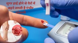डायबिटीज का स्तर 360mg/dl से ऊपर चला जाए को पैरों में होने लगती है ये खतरनाक परेशानी, स्थिति को नॉर्मल करना चाहते हैं, इन 5 तरीकों को तुरंत अपनाएं