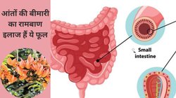 आंतों की परेशानी में लाभकारी है ये फूल, सूजन को कम करने में इस तरह करें सेवन, आचार्य बालकृष्ण से जानिए फायदे और तरीका