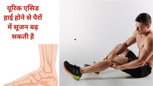 uric acid symptoms in male, uric acid sign in male at night, Symptoms Of High Uric Acid, यूरिक लेवल बढ़ने पर ये लक्षण, पुरुषों में हाई यूरिक लेवल के लक्षण, uric acid problem in hindi