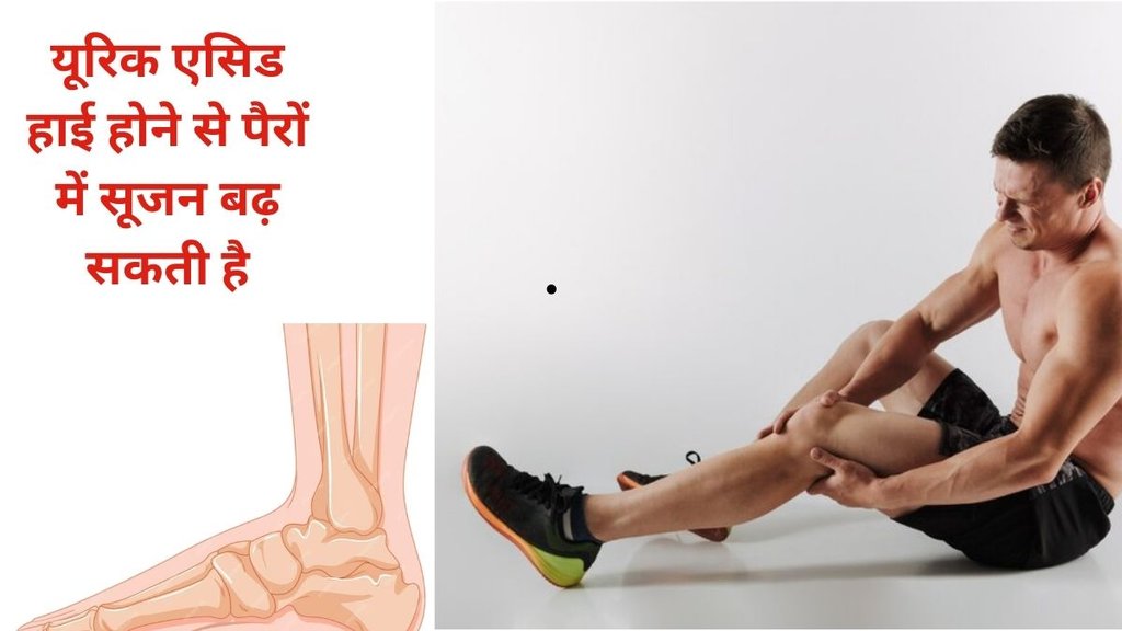 uric acid symptoms in male, uric acid sign in male at night, Symptoms Of High Uric Acid, यूरिक लेवल बढ़ने पर ये लक्षण, पुरुषों में हाई यूरिक लेवल के लक्षण, uric acid problem in hindi uric acid symptoms in male, uric acid sign in male at night, Symptoms Of High Uric Acid, यूरिक लेवल बढ़ने पर ये लक्षण, पुरुषों में हाई यूरिक लेवल के लक्षण, uric acid problem in hindi