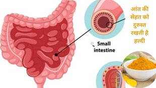 curcumin nanoemulsion, gut inflammation, Lactobacillus bacteria, bioavailability,, curcumin benefits, new study,आंतों की सूजन को दूर करने के लिए हल्दी का सेवन, हल्दी का सेवन करने के फायदे