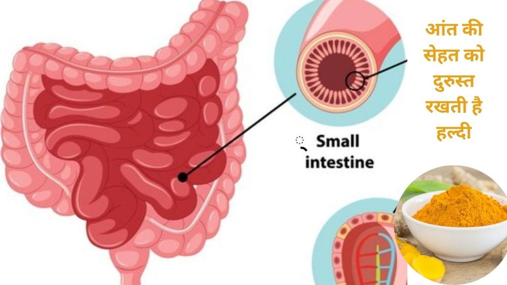 curcumin nanoemulsion, gut inflammation, Lactobacillus bacteria, bioavailability,, curcumin benefits, new study,आंतों की सूजन को दूर करने के लिए हल्दी का सेवन, हल्दी का सेवन करने के फायदे