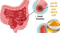 गैस, अपच, अल्सर और आंतों की सूजन से परेशान हैं तो हल्दी का करें सेवन, गट में बढ़ेंगे गुड बैक्टीरिया, पाचन भी रहेगा दुरुस्त