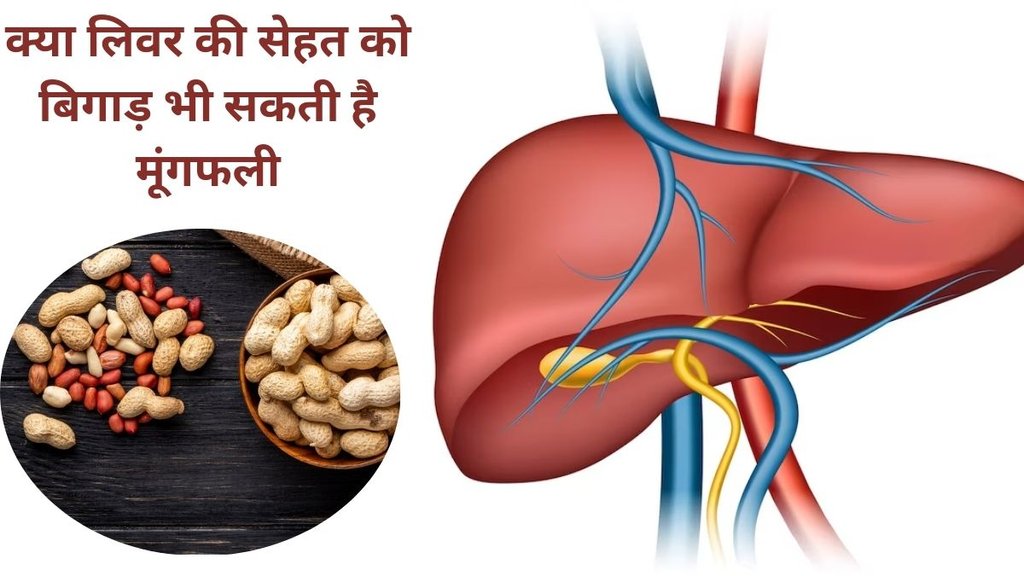 peanuts risks, how to consume peanuts, indianexpress.com, aflatoxin, liver damage,