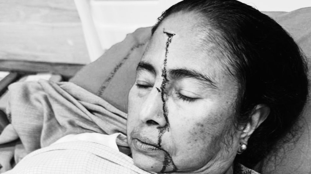 Mamata Banerjee Injured