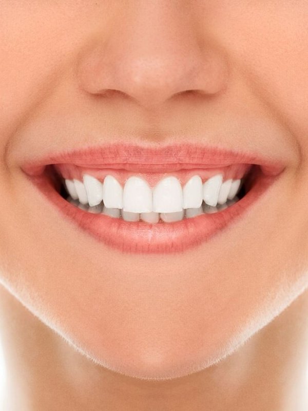 Teeth Whitening Tips । home remedies for white teeth । How to Get Rid of Yellow plaque on Teeth