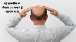 Reverse Hair Loss: इस नई तकनीक से बिना तकलीफ के ही सिर पर दोबारा से ग्रो हो जाएंगे बाल, डॉक्टर ने किया खुद पर एक्सपेरिमेंट