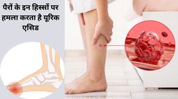 यूरिक एसिड हाई होने के अलार्मिंग साइन हैं पैरों में दिखने वाले ये 4 लक्षण, तुरंत करें पहचान,आचार्य बाल कृष्ण से जानिए आयुर्वेदिक उपचार
