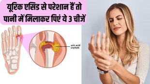 Uric Acid । Uric acid Home remedies । Uric Acid Treatment