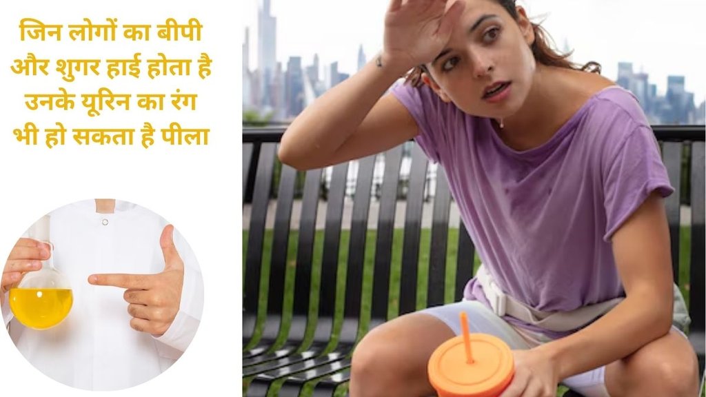 dark yellow urine even drinking a lot of water, why is my urine bright yellow, dark yellow urine causes, bright yellow urine no vitamins, dark yellow urine in the morning