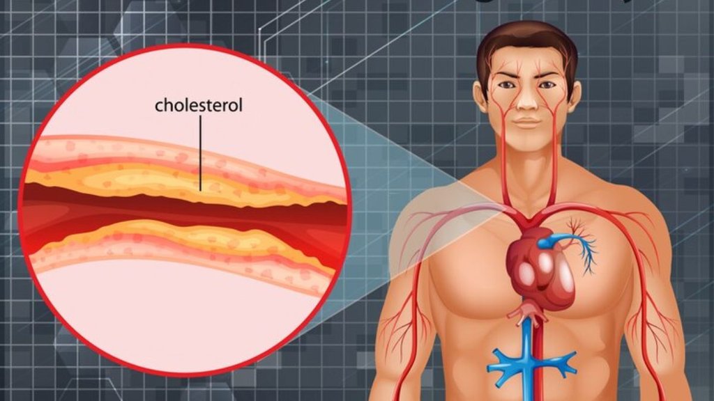cholesterol । cholesterol Control । plum for cholesterol