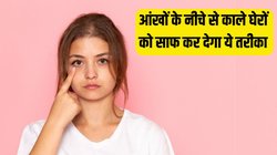 Dark Circles से डल और उम्रदराज दिखने लगा है चेहरा? महीने भर में आंखों के नीचे से काले घेरे साफ कर सकती है ये खास चीज, जानें इस्तेमाल का तरीका
