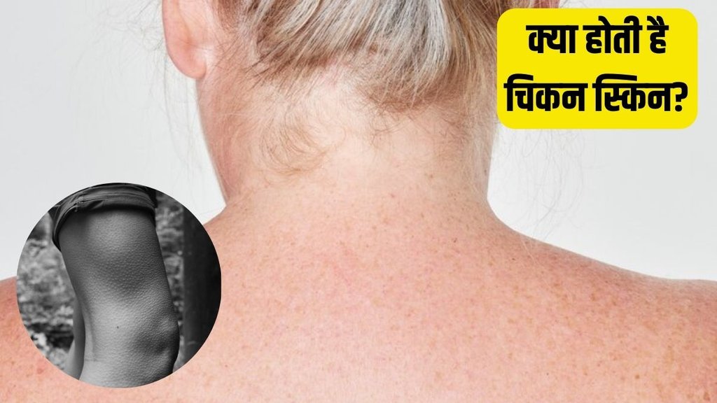 Keratosis Pilaris । Chicken Skin । Skin Care Tips