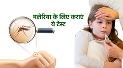  World Malaria Day 2024: दिख रहे हैं मलेरिया के लक्षण, तो तुरंत कराएं ये टेस्ट, इन बातों का भी रखें ख्याल