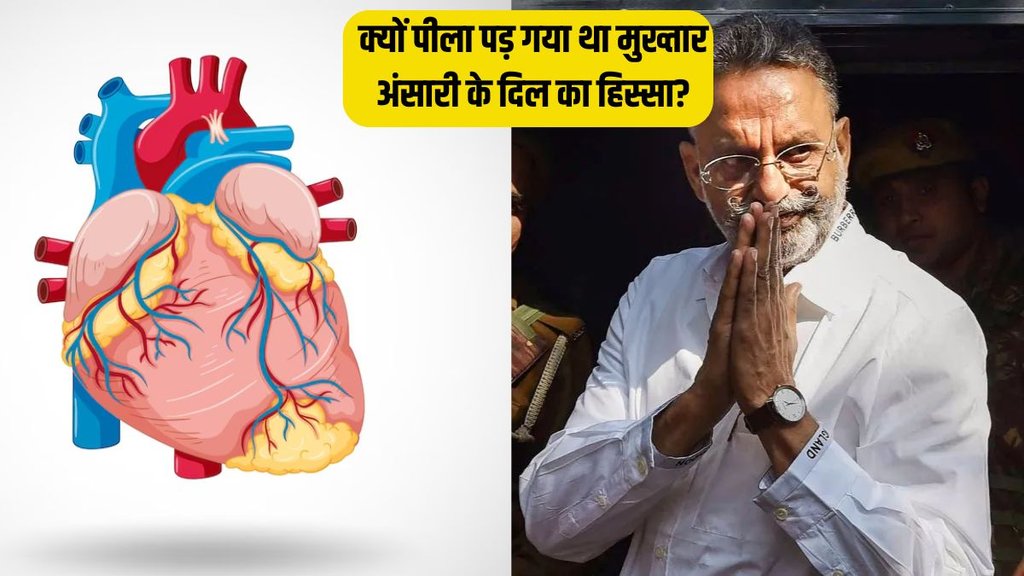 Mukhtar Ansari । Mukhtar Ansari autopsy report । Mukhtar Ansari Death Reason